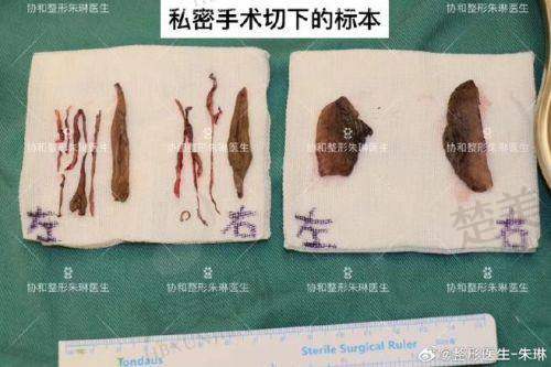 四、沈阳杏林整形外科医院——专科实力的信赖之选