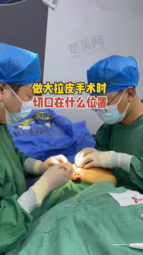 四、李晓东医生