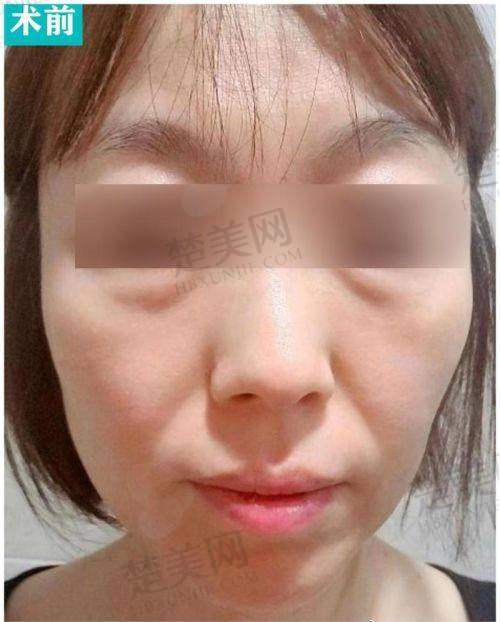 九、瞿健医生