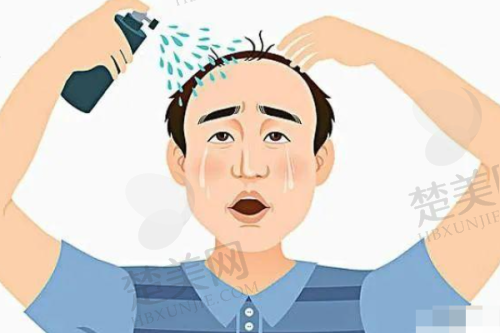 三、高难度植发失败修复：中德植发的实力担当