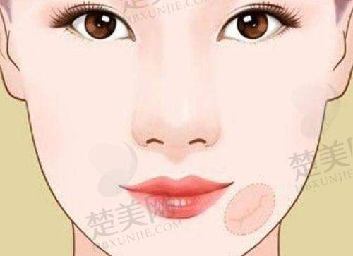 九、三亚美大夫丽格医疗美容门诊部真实的患者评价