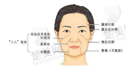 八、杭州整形医院预约方式