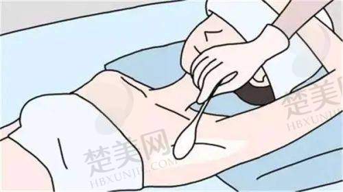 九、杭州艺然美医疗美容门诊部真实的患者评价