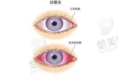 一、青岛华厦眼科医院是国有还是私立？答案揭晓