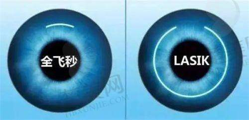 二、老年人免费治疗白内障的条件解读