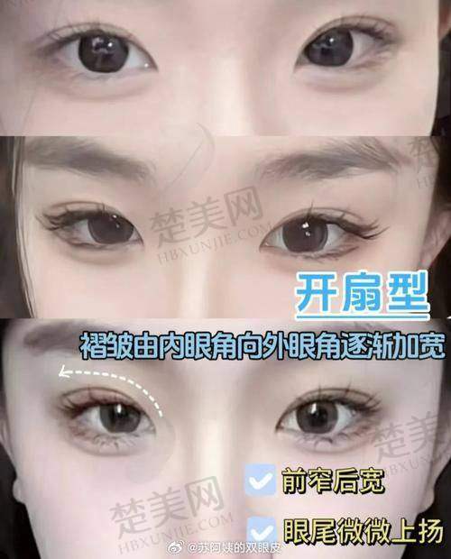 五、师丽丽医生——北京丰联丽格医疗美容