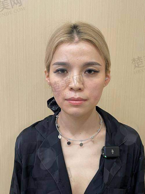 二、王阔远医生的娴熟技术