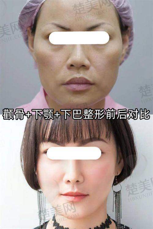 四、王阔远医生的沟通能力