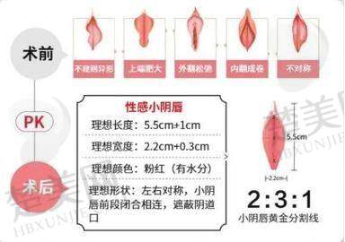 一、四川大学华 西医院——私密整形的专精具有影响力之选