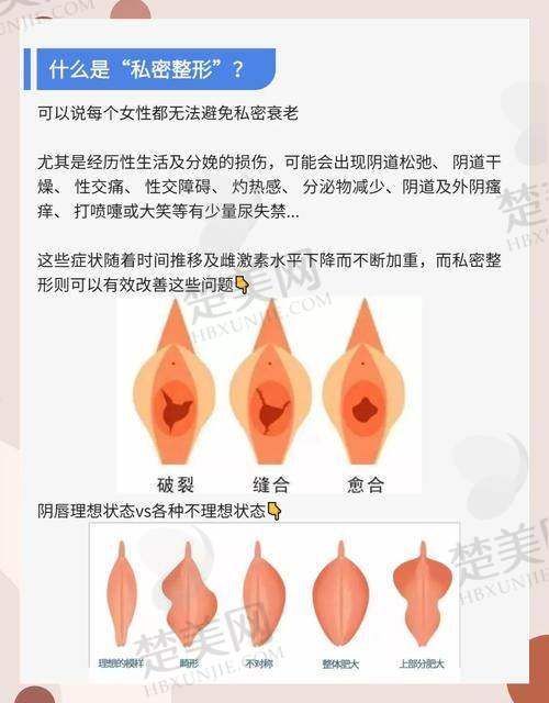 四、武汉龚美云医生技术优势