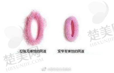 一、武汉真爱私密整形医院资质与背景怎么样