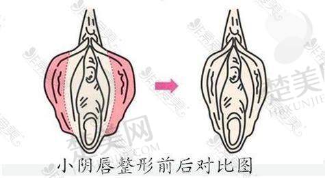 总结：国有优质医院守护你的私密健康