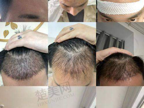四、正规资质加持，实力与保护并存