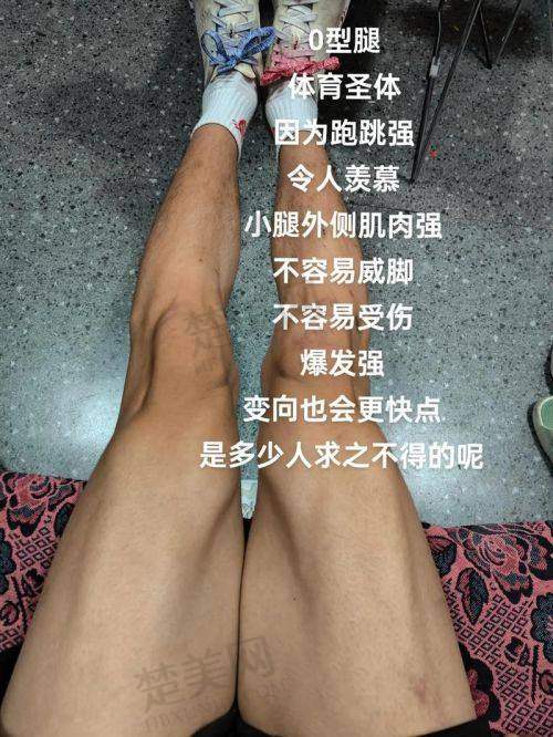 三、直腿术相关问题解答