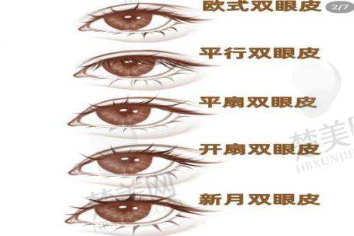 六、青岛壹美天成白华宝：预留脂肪避免眼窝凹陷