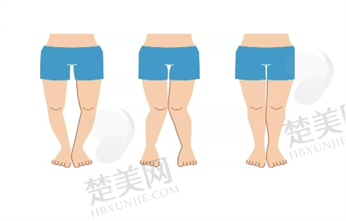 四、池州灵创医疗美容门诊部特色项目