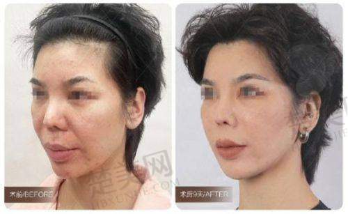 八、合肥壹加壹美容医院预约方式