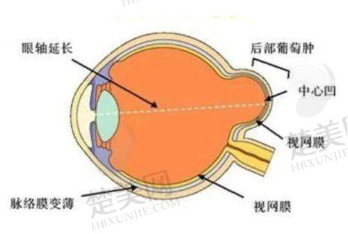 一、漳州华厦眼科医院看一次要多少钱——基础检查费用情况