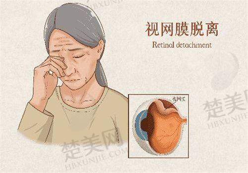 四、宁德华厦眼科医院的服务与口碑