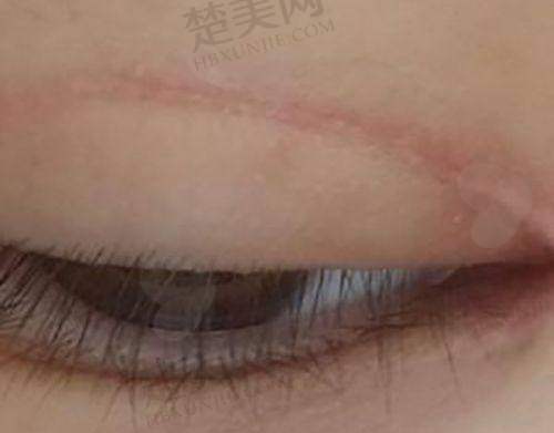 二、亳州康美医疗美容诊所怎么样？