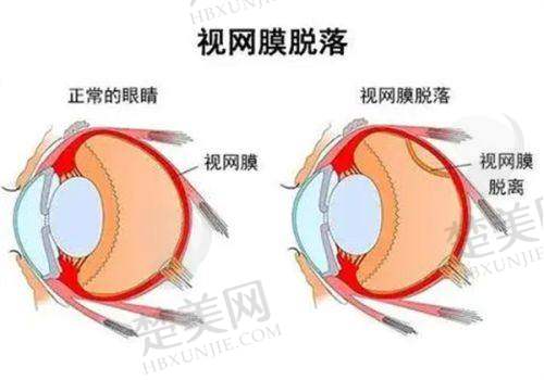 三、华德眼科医院的收费情况——价格合理，性价比高