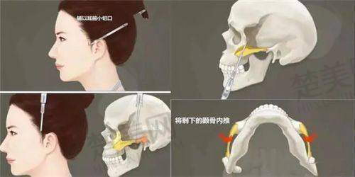 一、合肥壹加壹美容医院正规吗？