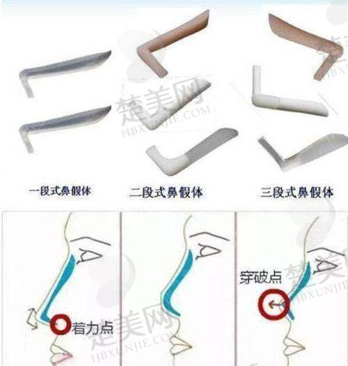 八、亳州康美医疗美容诊所预约方式