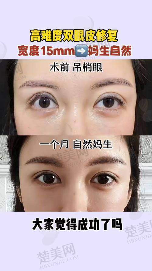 五、吴焱秋医生的口碑情况