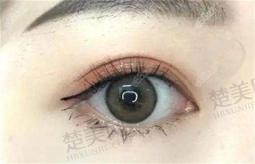 总结