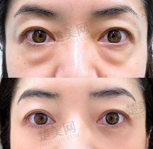 一、杨胜发医生——郑州缔莱美医疗美容医院实力担当