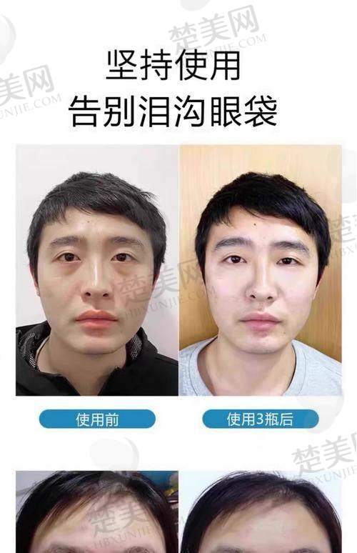 二、李霞医生——郑州华领医疗美容医院的出色代表
