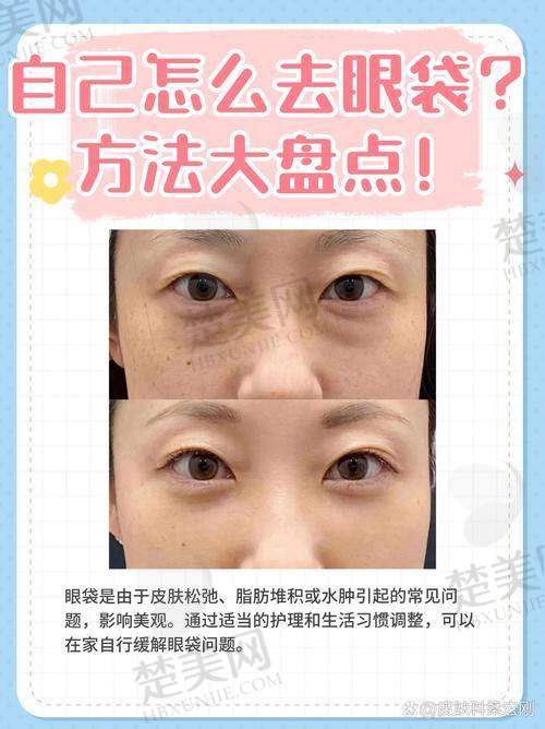 三、贺洁院长眼袋修复费用明细