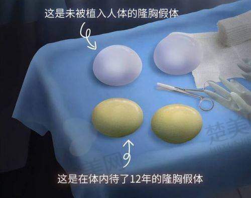 八、万友望医生 - 广州曙光整形美容医院
