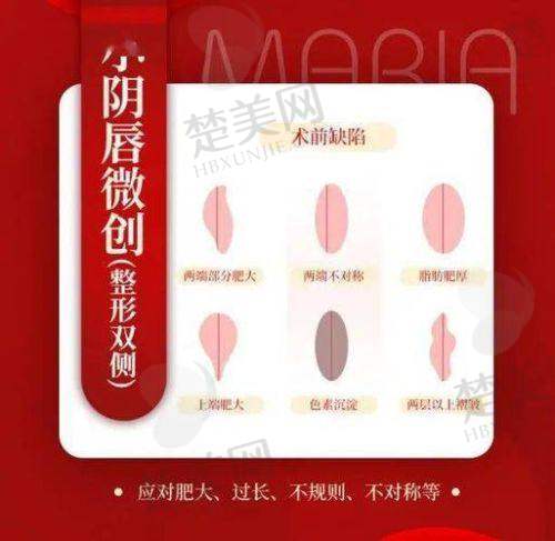 七、成都棕南医院私密整形手术的术后成效和口碑怎样啊