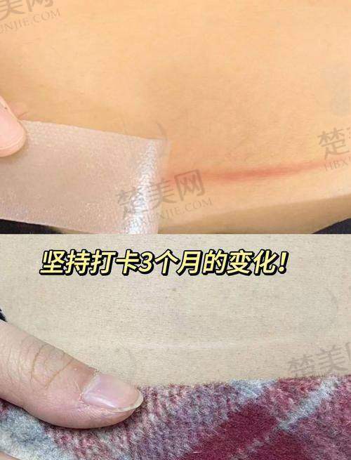 六、其他值得关注的疤痕修复医院