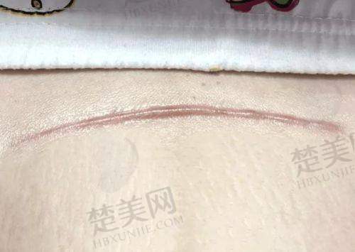 二、兰州大学第二医院——综合实力强劲的疤痕修复医院