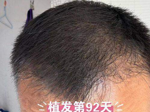 七、太原显微植发医院地址及交通