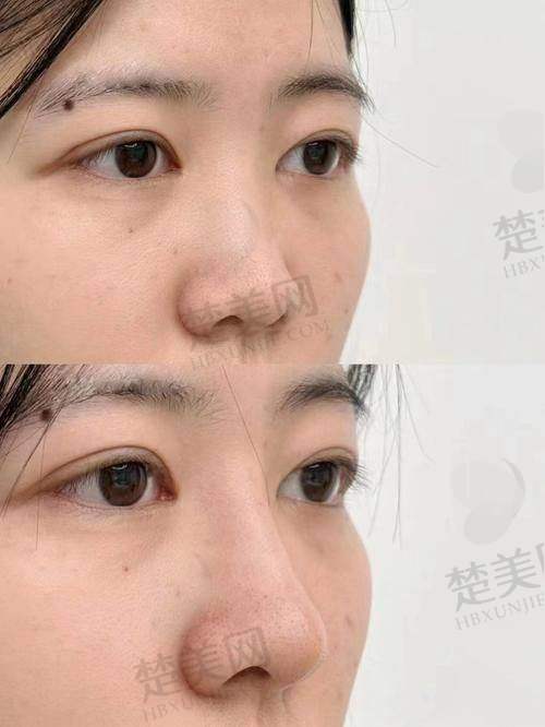 五、与其他填充材料对比