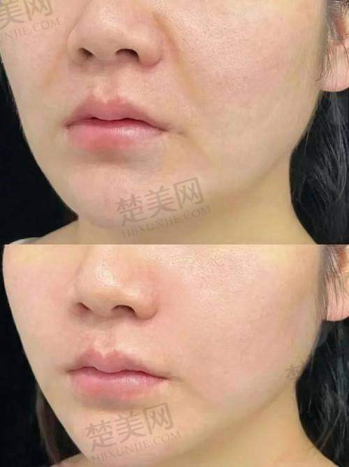 三、成效把控