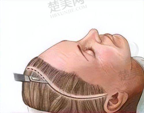 一、宁德铧媄医疗美容门诊部正规吗？