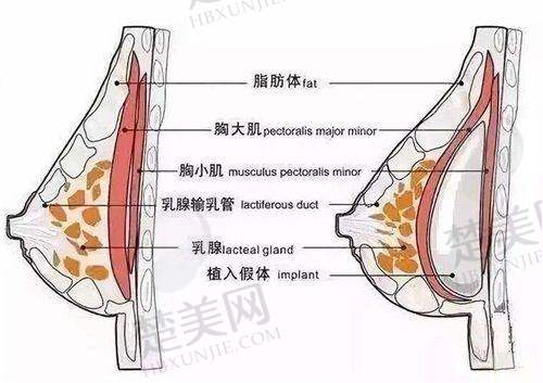 三、评估朴一飞医生手术成功几率的注意事项
