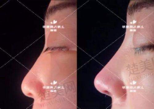 七、总结