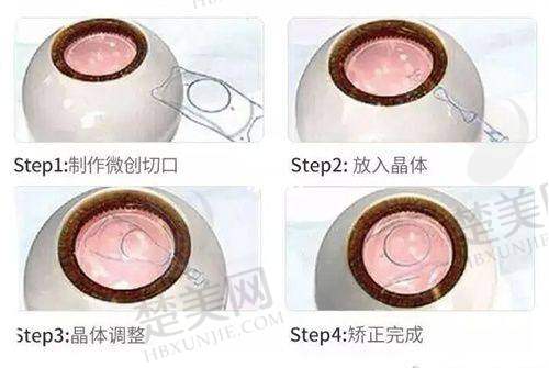 七、福清亮睛眼科医院地址及交通