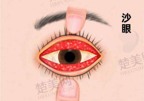 二、福清亮睛眼科医院怎么样？