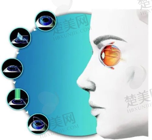 八、福州爱尔眼科医院预约方式