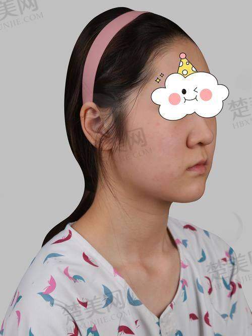 一、厦门膨体隆鼻医院排名靠前医院之厦门大学附属第一医院整形美容烧伤科