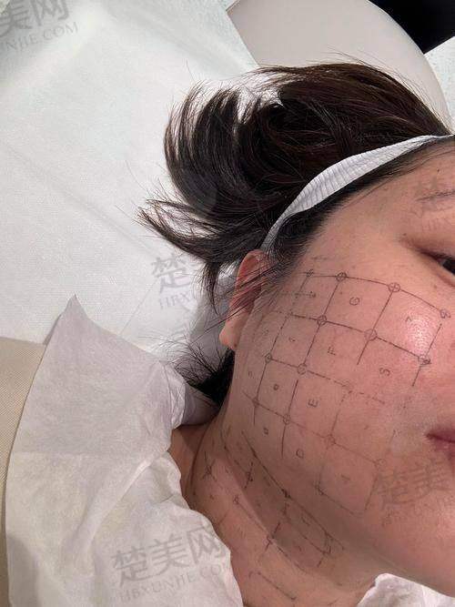 三、上海热玛吉认证机构和认证医生的区别