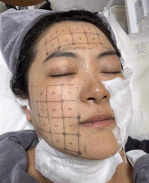 一、上海热玛吉认证机构大揭秘