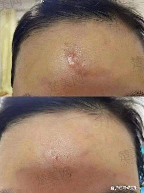七、黄立医生——华中科技大学同济医学校附属同济医院主事医师