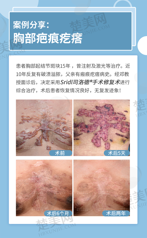 八、丛晓斌医生——武汉市第六医院整形美容外科骨干医生